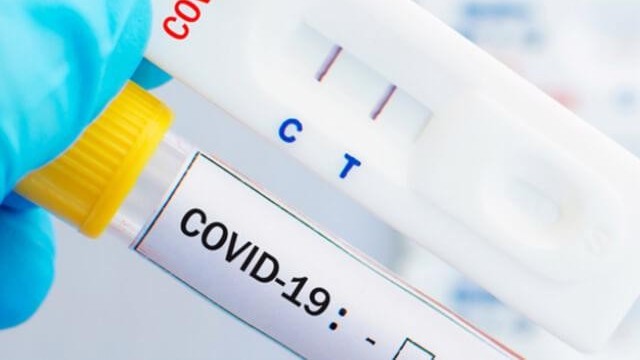 covid19 ngay 311 hon 800 ca mac moi 244 nguoi khoi benh khong co truong hop tu vong