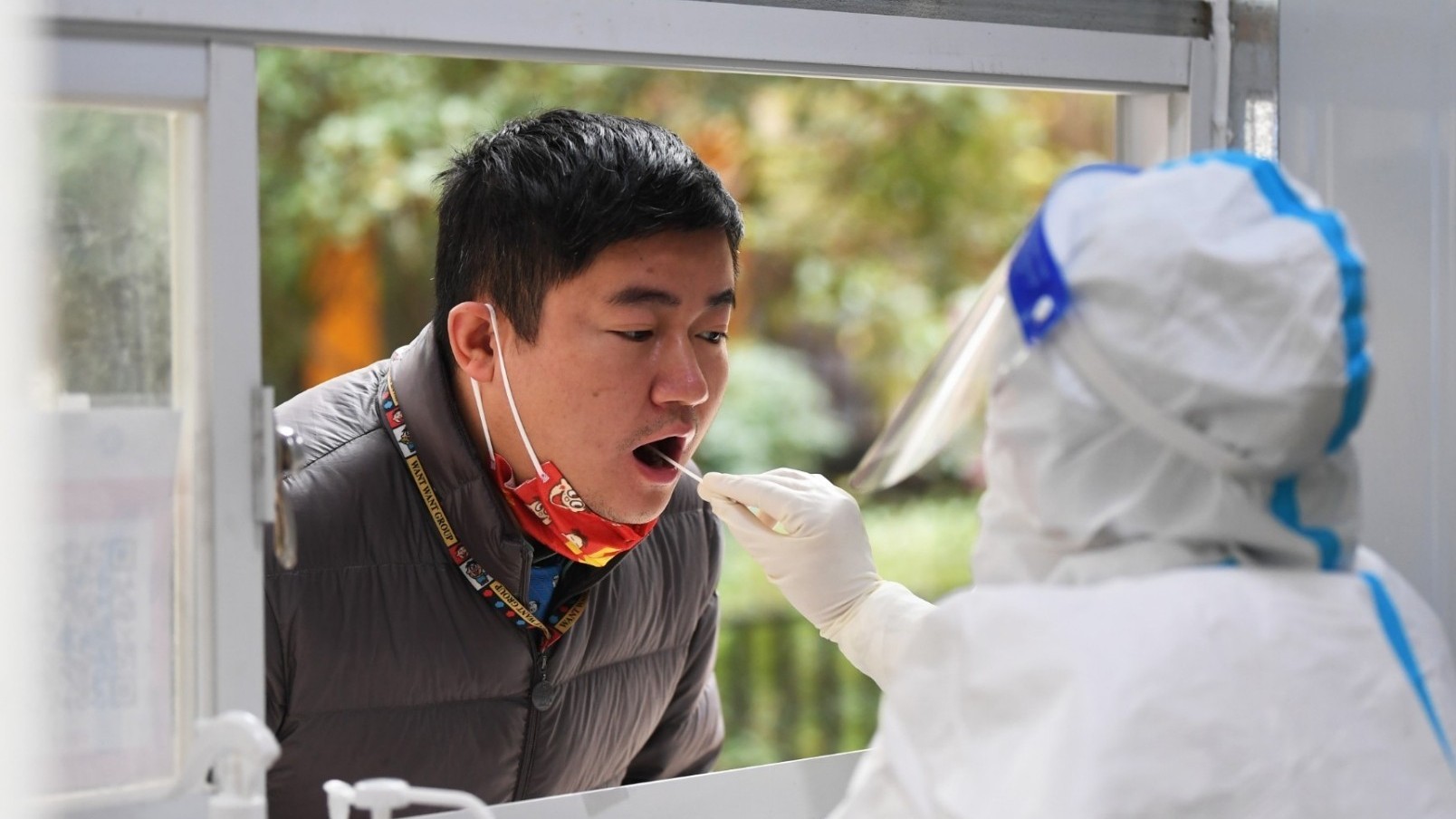 who covid19 co the chi con gay nguy hiem nhu cum mua