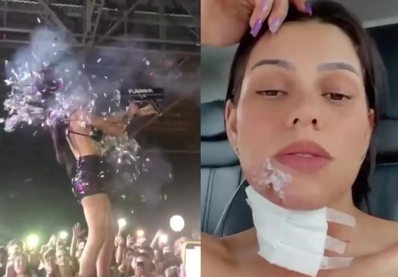 DJ Flavinha bị bỏng vì cầm ngược súng bắn pháo giấy