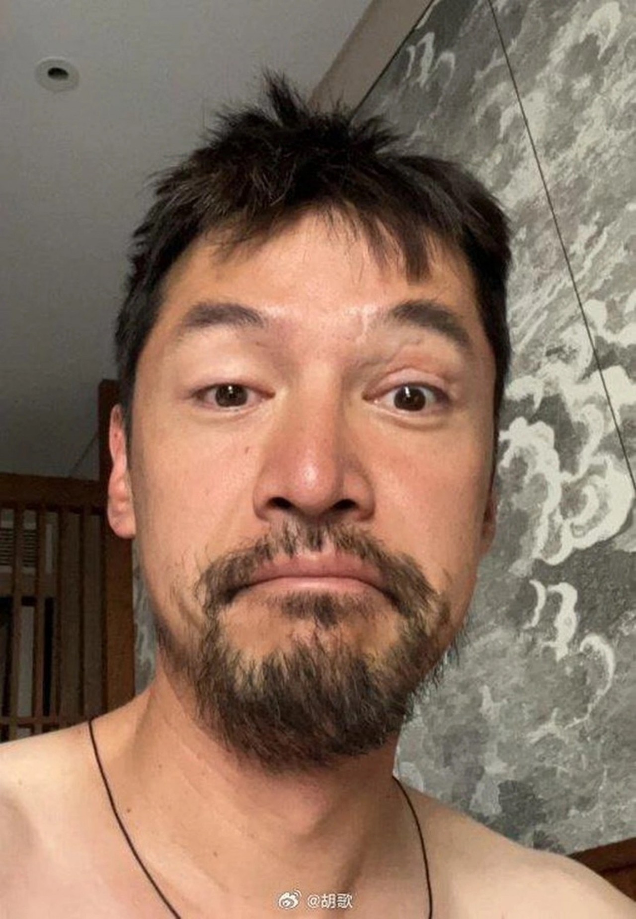 Nam diễn viên đình đám Cbiz Hồ Ca lộ hình ảnh xuống sắc bất thường