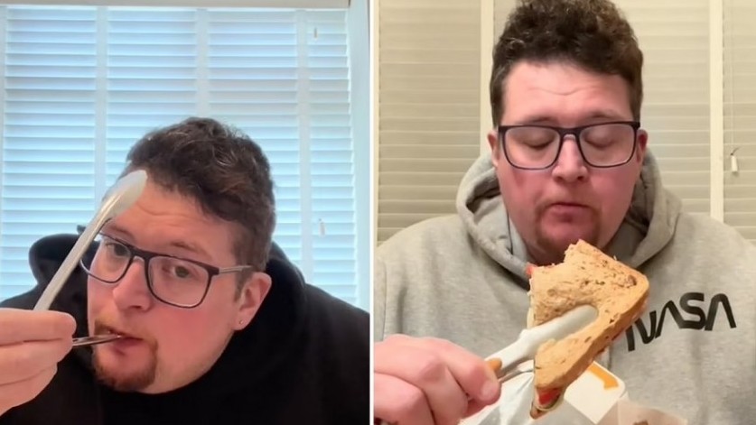 anh cau chuyen ve nguoi dan ong mac benh hiem gap so cham tay vao thuc an nau chin