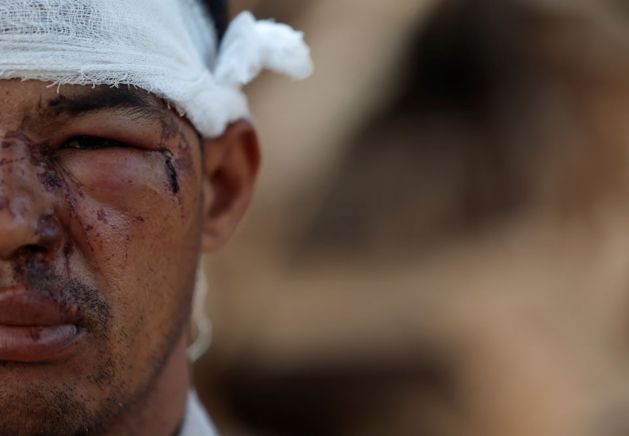 Khung cảnh đau thương sau trận động đất làm rung chuyển Nepal