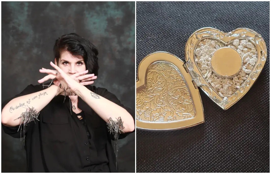 Mỹ: Cấy ghép 52 bộ phận bằng kim loại trong cơ thể, người phụ nữ lập kỷ lục Guinness thế giới