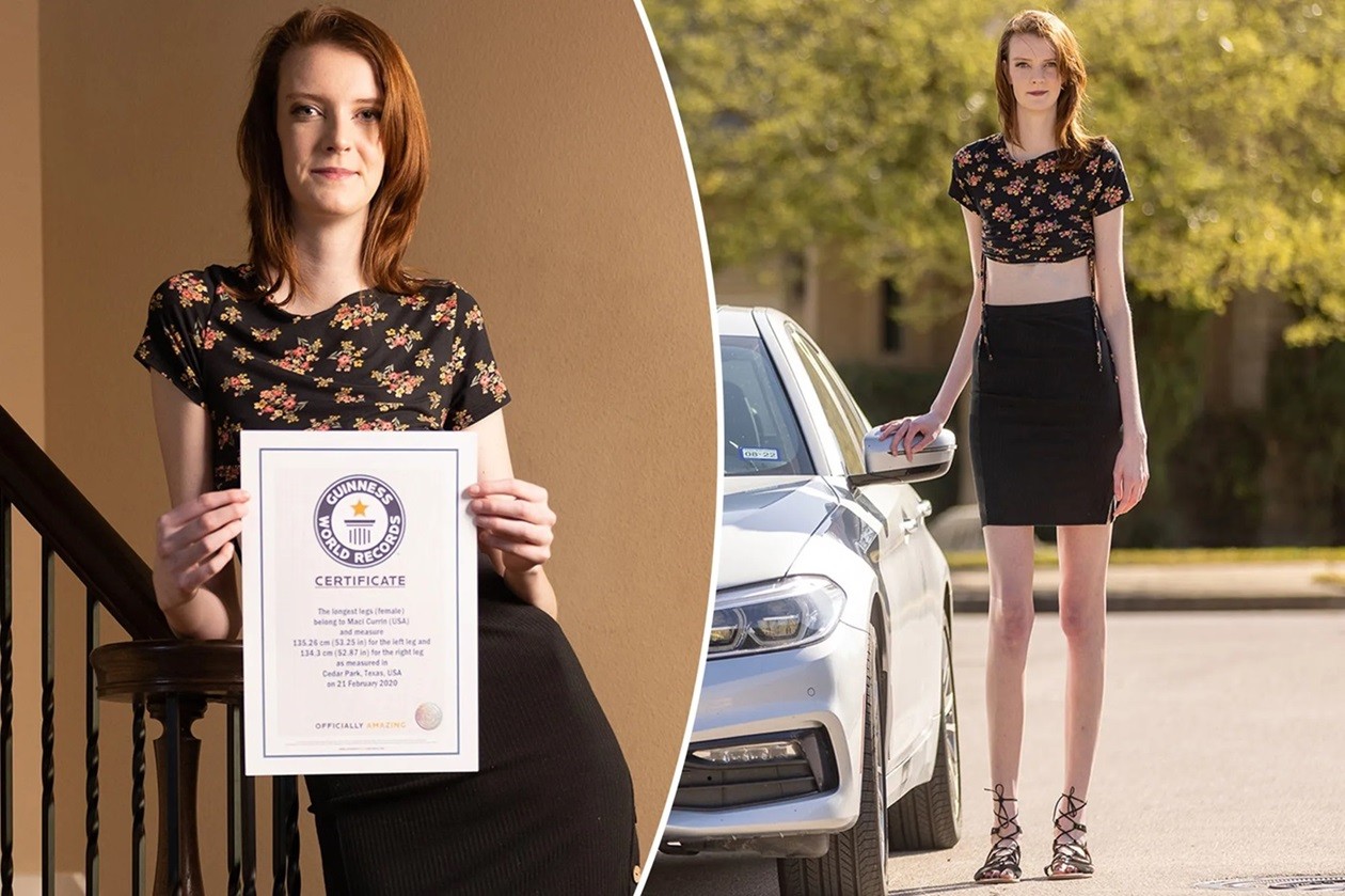 Cô gái có đôi chân dài nhất thế giới tâm sự về những trở ngại trong cuộc sống