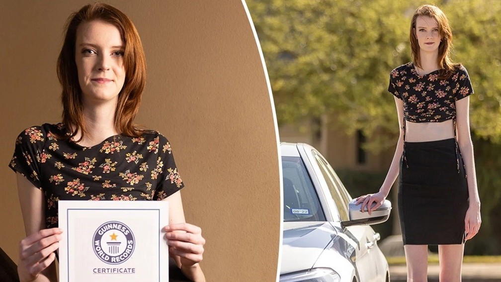 Cô gái có đôi chân dài nhất thế giới tâm sự về những trở ngại trong cuộc sống