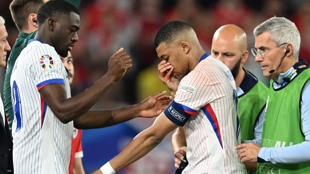 Mbappe sẽ phải đeo mặt nạ nếu thi đấu EURO 2024