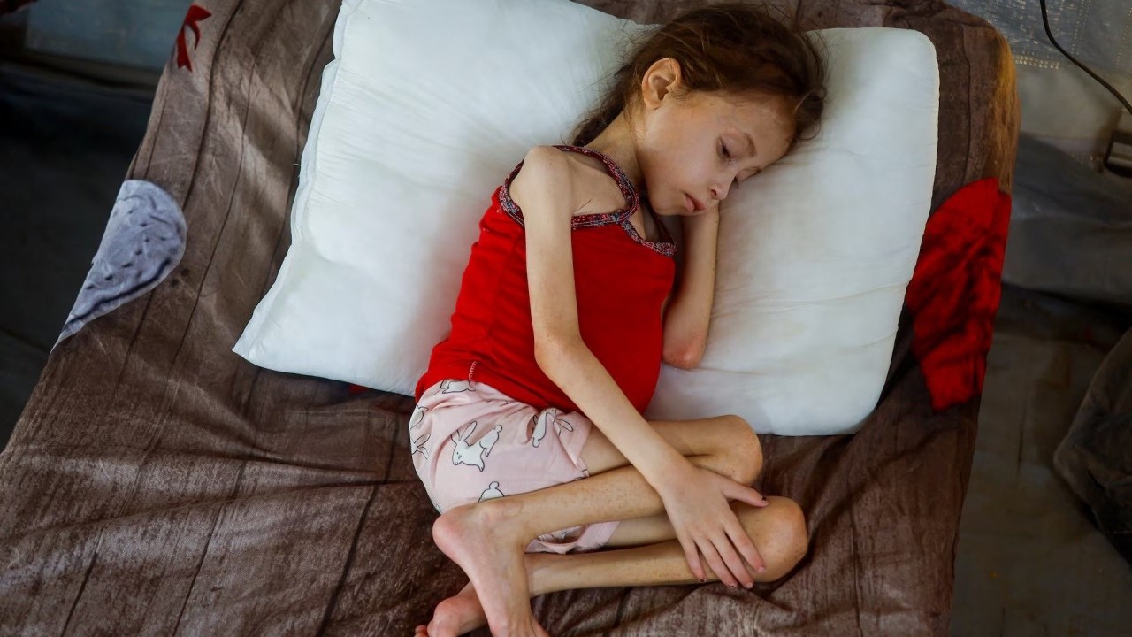 Xung đột Israel-Palestine: Trẻ em Gaza đối mặt với nạn đói cùng cực