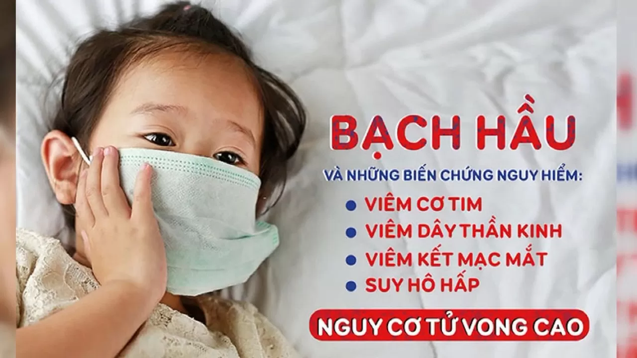 Thủ tướng ra Công điện yêu cầu không để lây lan, bùng phát bệnh bạch hầu Thủ tướng ra công điện yêu cầu không để lây lan, bùng phát bệnh bạch hầu