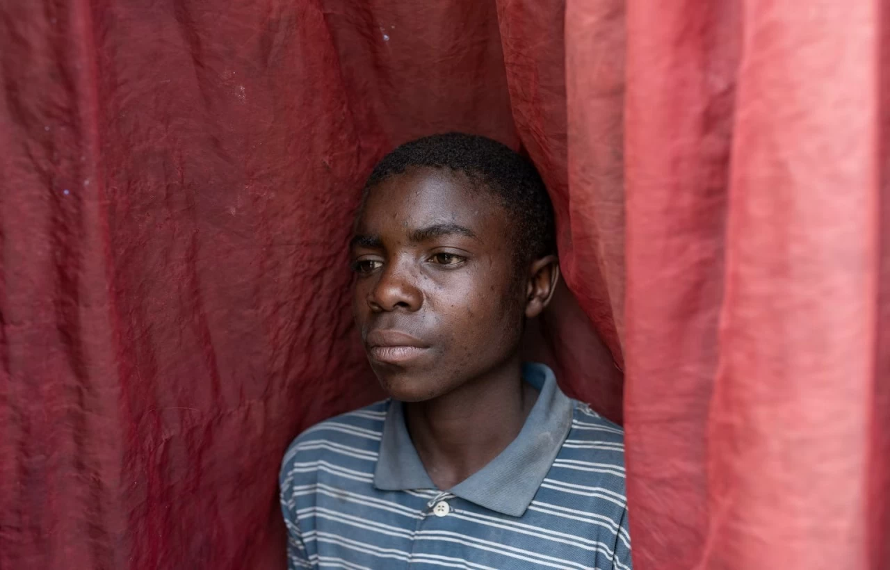 Hình ảnh tuyến đầu của đợt bùng phát bệnh đầu mùa khỉ nghiêm trọng ở Congo Hình ảnh tuyến đầu của đợt bùng phát bệnh đầu mùa khỉ nghiêm trọng ở Congo