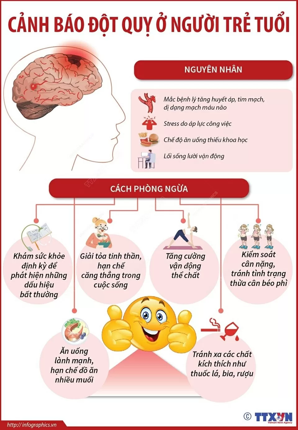 Nguyên nhân và cách phòng ngừa đột quỵ ở người trẻ tuổi