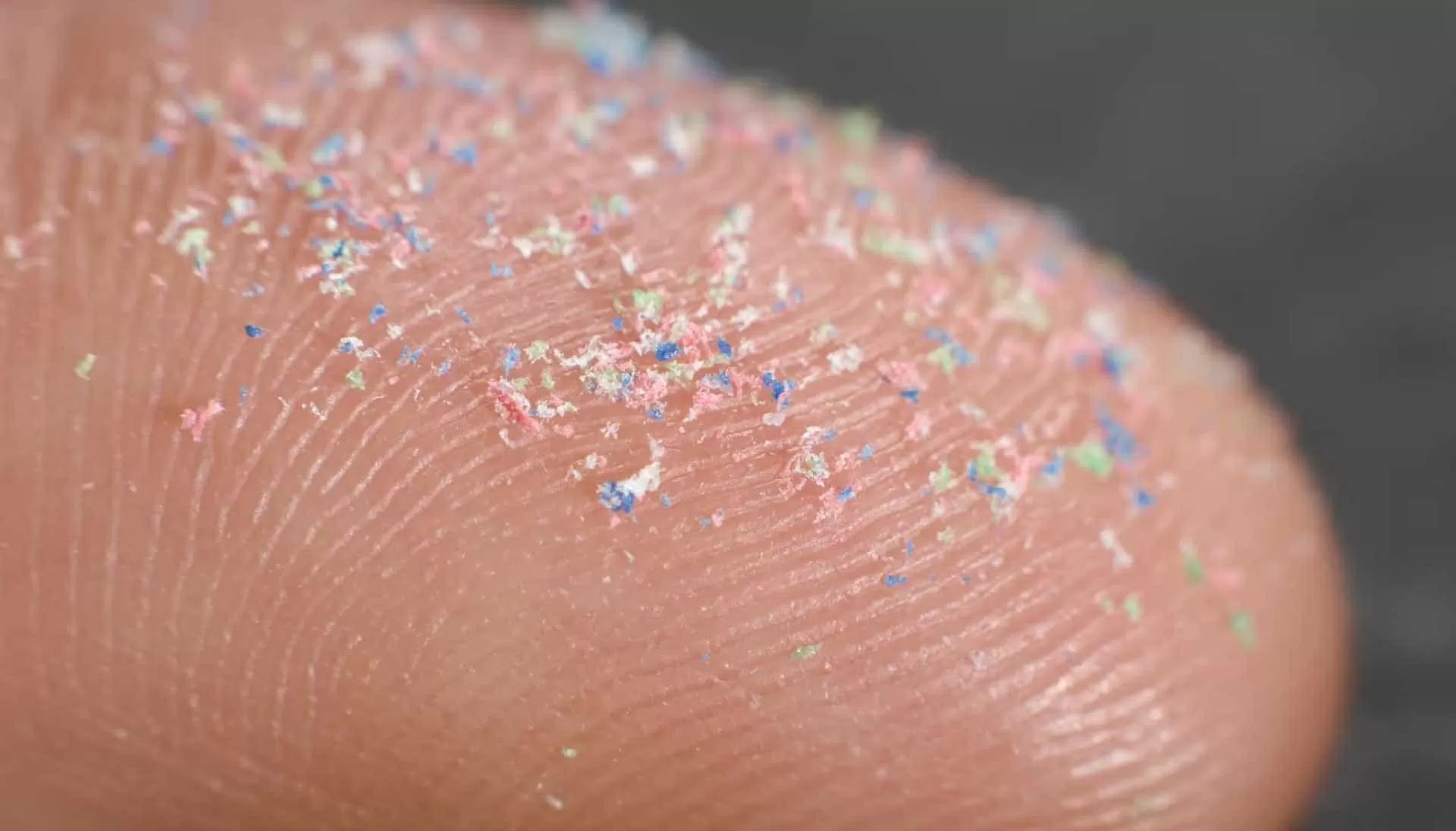 Phát hiện mới về vi nhựa trong não người Phát hiện mới về vi nhựa trong não người