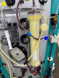 Chuyên gia y tế nói gì về chuyện 'lọc máu ngừa đột quỵ'?