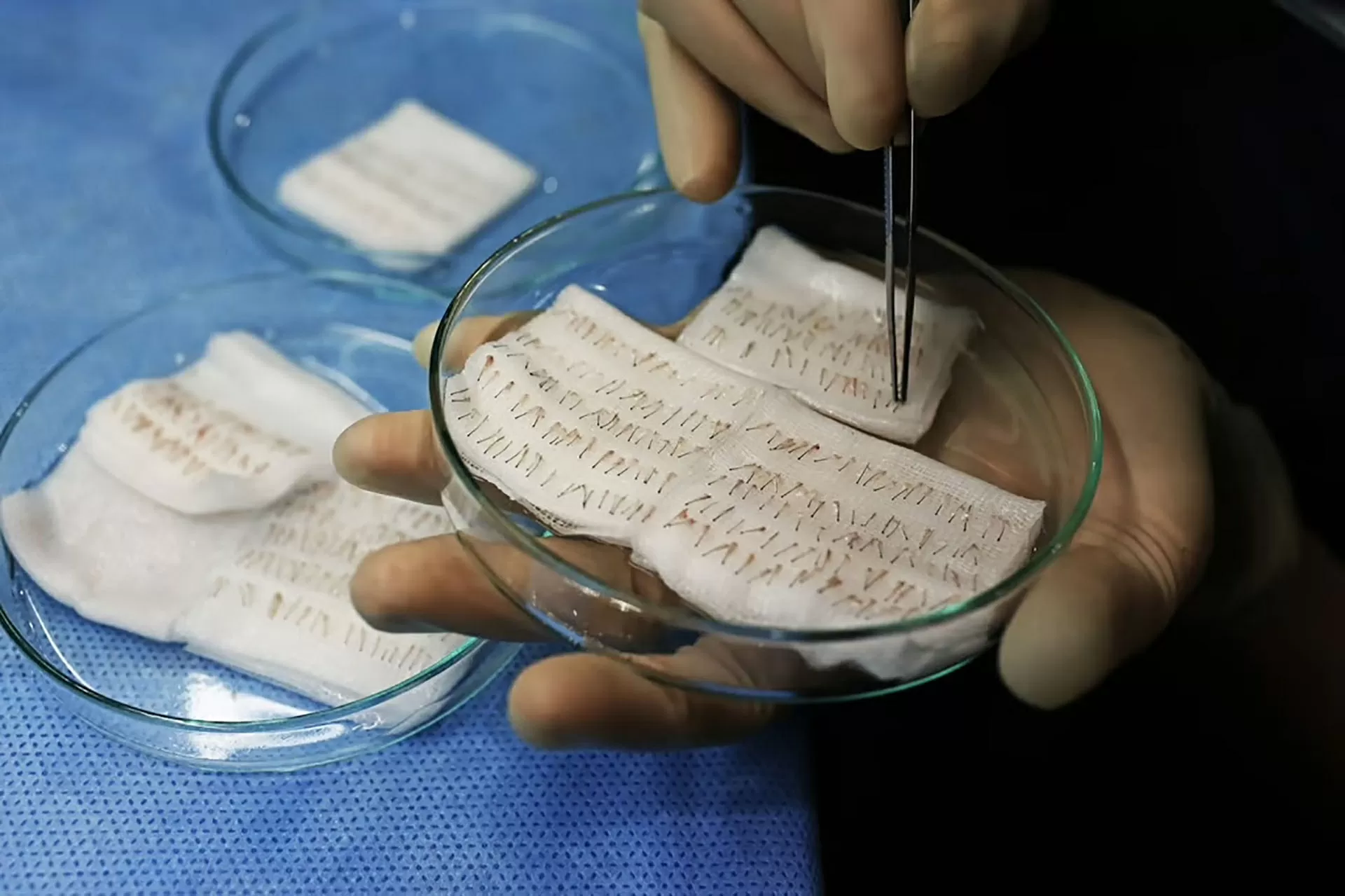 ‘Thủ phủ cấy tóc’ thế giới ‘Thủ phủ cấy tóc’ thế giới