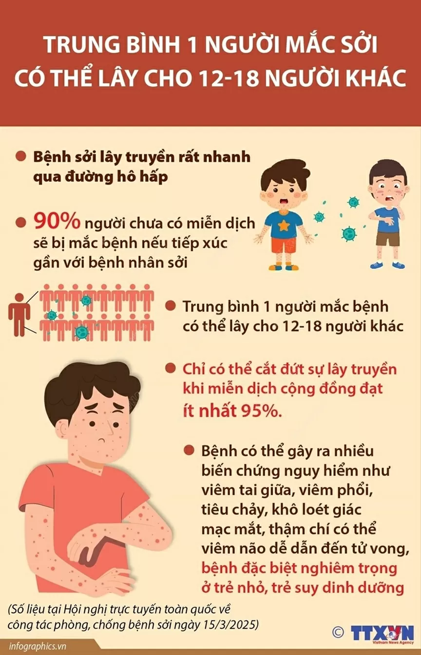 bệnh sởi