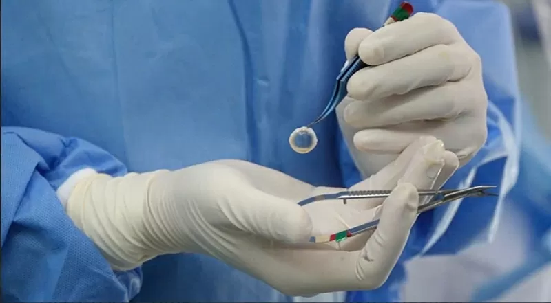 Bác sĩ tiếp nhận giác mạc của người hiến chết não. (Ảnh bệnh viện cung cấp) Bác sĩ tiếp nhận giác mạc của người hiến chết não. (Ảnh bệnh viện cung cấp)