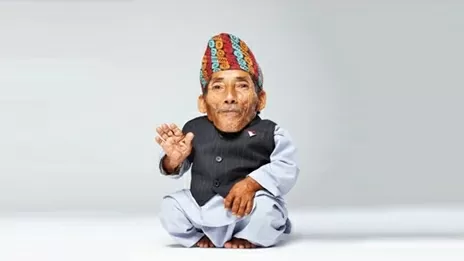 Nepal: Người đàn ông thấp nhỏ nhất thế giới do mắc hội chứng đặc biệt hiếm gặp Nepal: Người đàn ông thấp nhỏ nhất thế giới do mắc hội chứng đặc biệt hiếm gặp