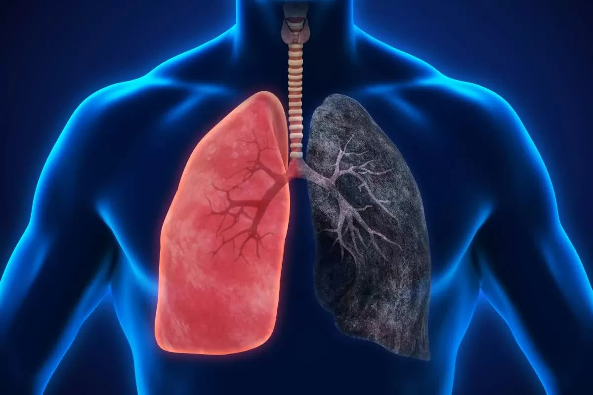 Ngày Thế giới Không thuốc lá: Tác hại sâu rộng của khói thuốc không chỉ dừng lại ở phổi và tim. (Nguồn: Shutterstock) Ngày Thế giới Không thuốc lá: Tác hại sâu rộng của khói thuốc không chỉ dừng lại ở phổi và tim. (Nguồn: Shutterstock)