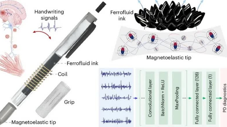 Mỹ chẩn đoán bệnh Parkinson qua một thiết bị