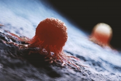 Xét nghiệm máu mới phát hiện ung thư trước khi có triệu chứng 3 năm