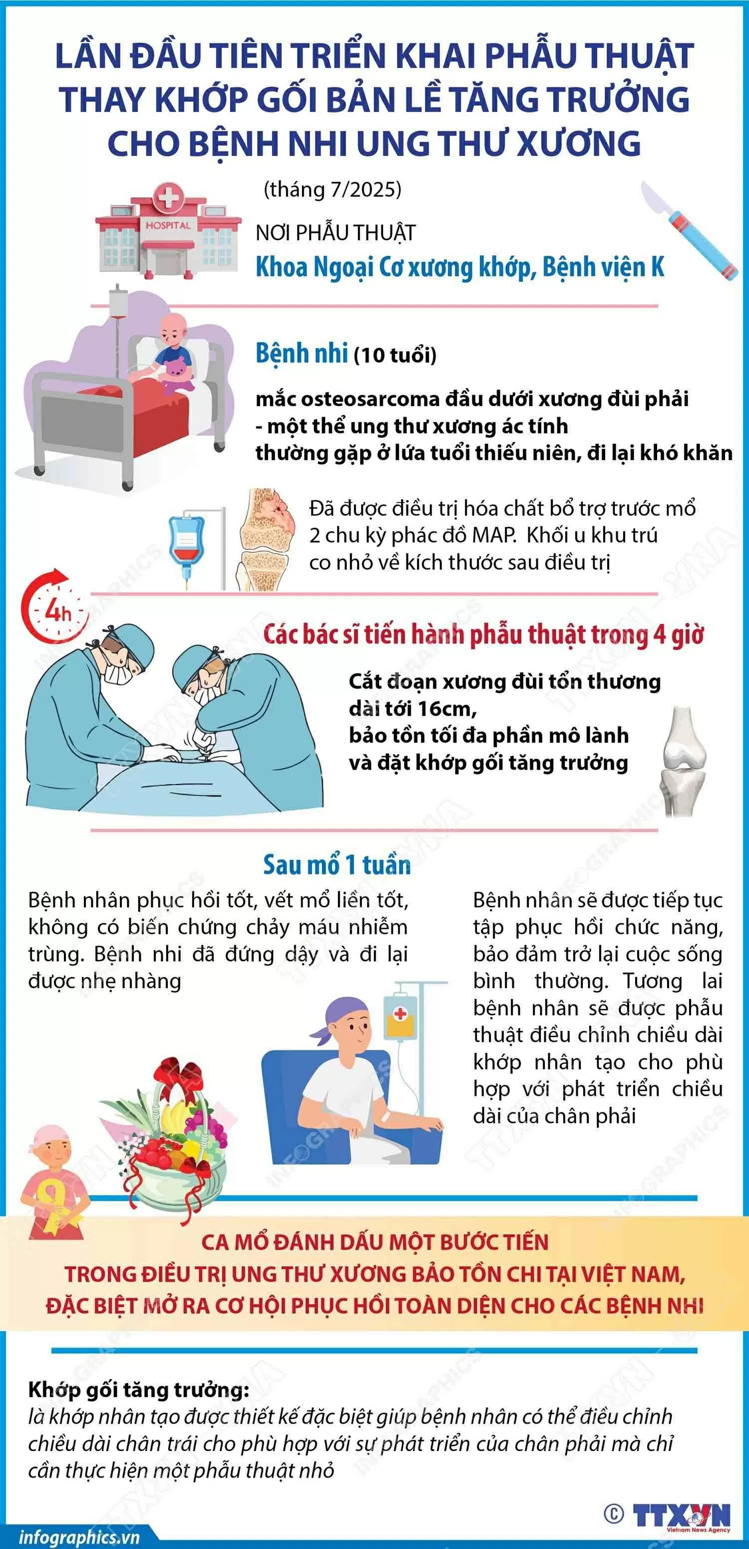 Ca phẫu thuật đánh dấu bước tiến mới trong điều trị bảo tồn chi thể, mang lại hy vọng cho trẻ em mắc bệnh hiểm nghèo./.