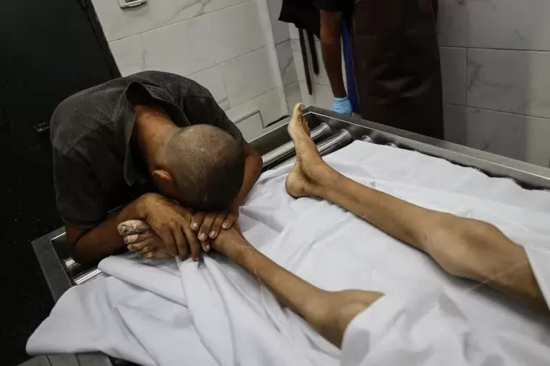 Thi thể của Atef Abu Khater, 17 tuổi, người đã chết vì suy dinh dưỡng, được nhìn thấy tại một bệnh viện ở Thành phố Gaza vào ngày 2 tháng 8 năm 2025