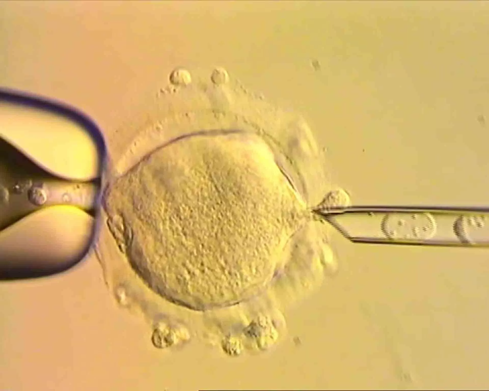 Liệu pháp hiến tặng ty thể cho phép tạo phôi IVF mang ADN từ ba người, nhằm ngăn ngừa các bệnh di truyền nghiêm trọng. (Nguồn: Đại học Newcastle)