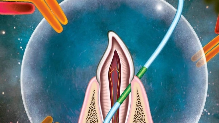 mot loai vaccine moi khong can kim tiem co tac dung nhu chi nha khoa can nghien cuu them