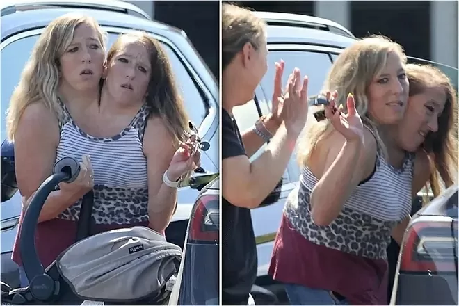 Cặp song sinh dính liền nổi tiếng gây tò mò sau loạt ảnh mới