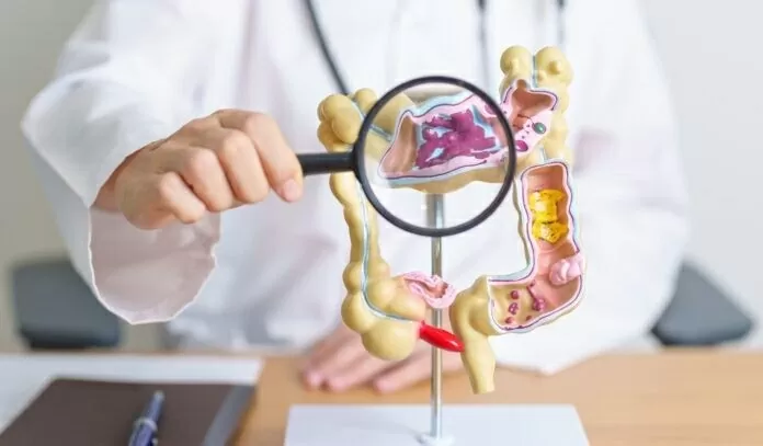 Phát triển máy in sinh học siêu nhỏ có thể chữa lành loét dạ dày