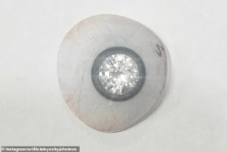 Gắn viên kim cương vào mắt giả, chủ tiệm kim hoàn có con mắt nhân tạo đắt nhất thế giới