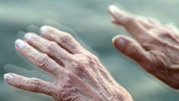 Lần đầu tiên giới khoa học quan sát được tác nhân khởi phát bệnh Parkinson