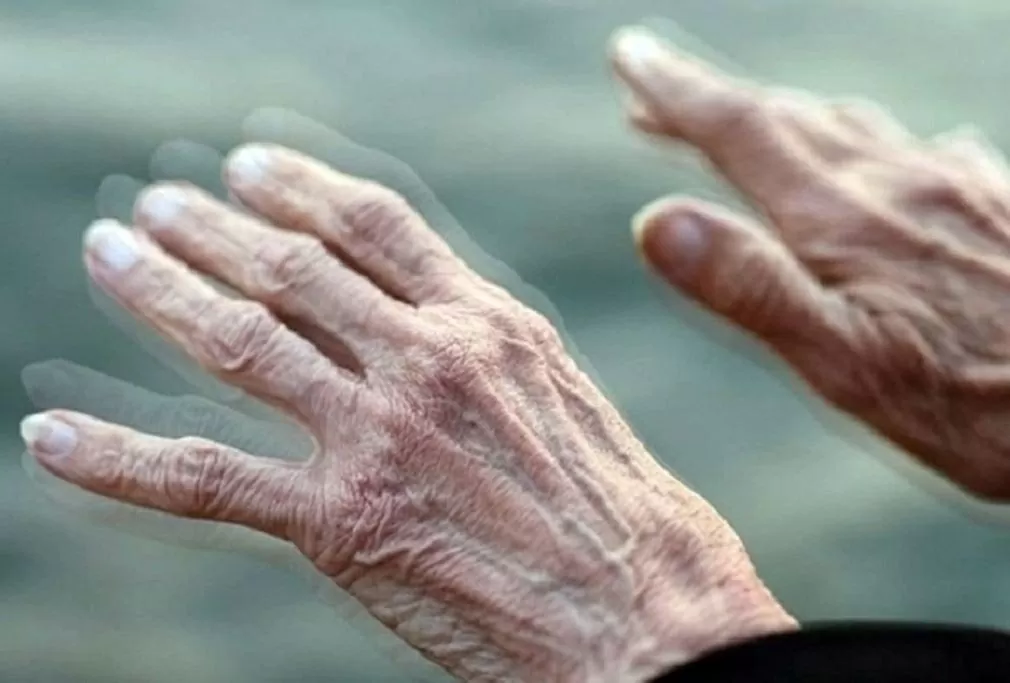 Lần đầu quan sát được mồi lửa khởi phát bệnh Parkinson