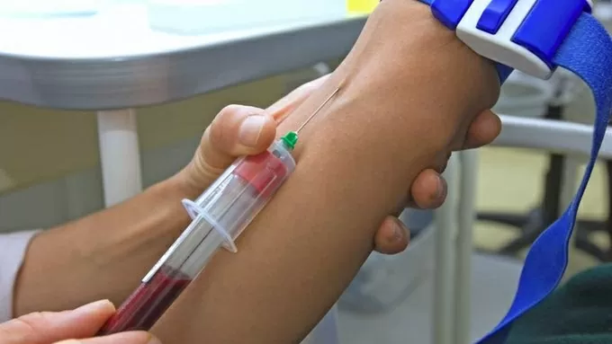 Xét nghiệm máu di truyền giúp dự báo nguy cơ đau tim và đột quỵ Xét nghiệm máu di truyền có thể phát hiện sớm nguy cơ đau tim và đột quỵ