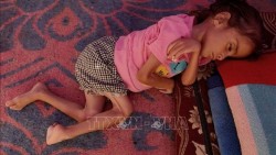 UNICEF cảnh báo hàng nghìn trẻ Gaza suy dinh dưỡng cấp tính