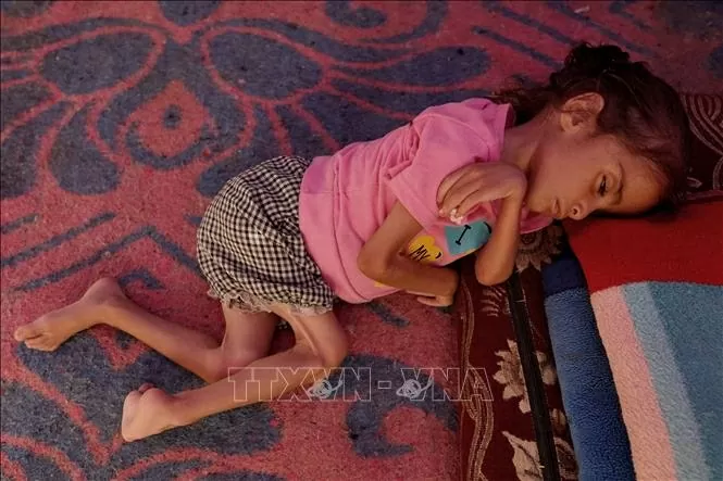 UNICEF: Hàng nghìn trẻ Gaza suy dinh dưỡng cấp tính