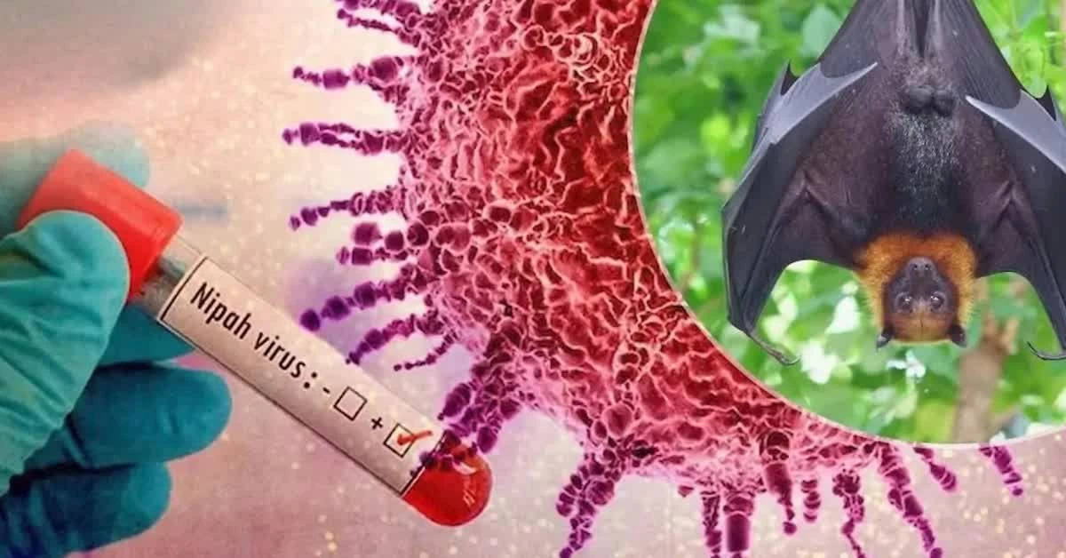 Virus Nipah tại Ấn Độ: Chưa có thuốc điều trị, tỷ lệ tử vong cao, châu Á khẩn cấp kích hoạt phản ứng Virus Nipah tại Ấn Độ: Chưa có thuốc điều trị, tỷ lệ tử vong cao, châu Á khẩn cấp kích hoạt phản ứng