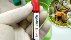 Virus Nipah và lời cảnh báo nghiêm khắc từ sự xâm lấn môi trường sống