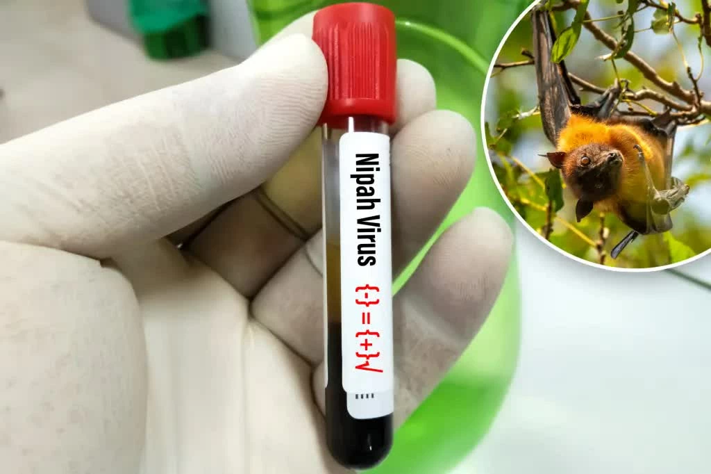 Virus Nipah và lời cảnh báo nghiêm khắc từ sự xâm lấn môi trường sống Virus Nipah và lời cảnh báo nghiêm khắc từ sự xâm lấn môi trường sống