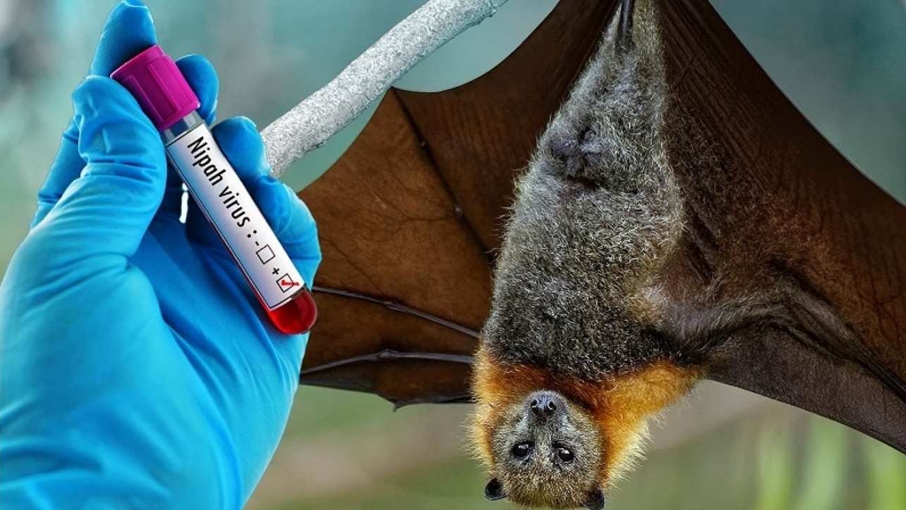 Bộ Y tế hướng dẫn chẩn đoán và điều trị bệnh do virus Nipah