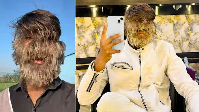 Chàng trai người sói và hành trình nổi bật giữa hàng triệu người Chàng trai người sói và hành trình nổi bật giữa hàng triệu người