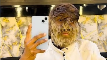 Chàng trai 'người sói' và hành trình nổi bật giữa hàng triệu người