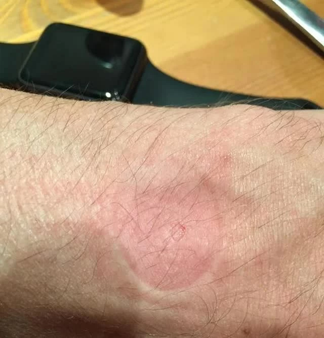 Điều khiến dư luận quan tâm hơn là thái độ hỗ trợ khách hàng từ Apple. 