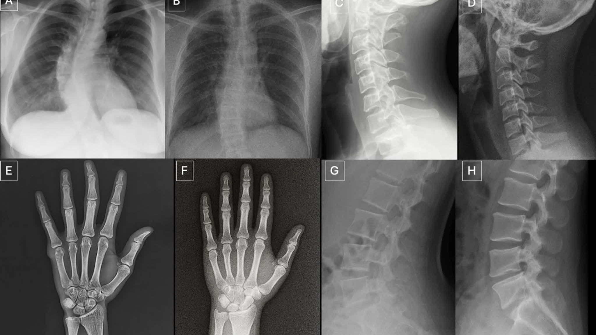Bác sĩ có thể bị AI đánh lừa