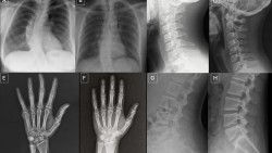 Bác sĩ có thể bị AI đánh lừa