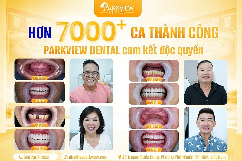 Kết quả khách hàng đã thăm khám tại Parkview Dental.