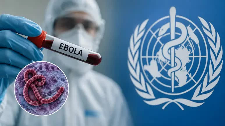 Dịch Ebola tại CHDC Congo diễn biến nghiêm trọng với hơn 200 ca tử vong, nguy cơ lan rộng ở châu Phi
