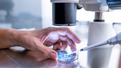 Bước tiến mới giúp người bệnh ung thư vú không cần hóa trị