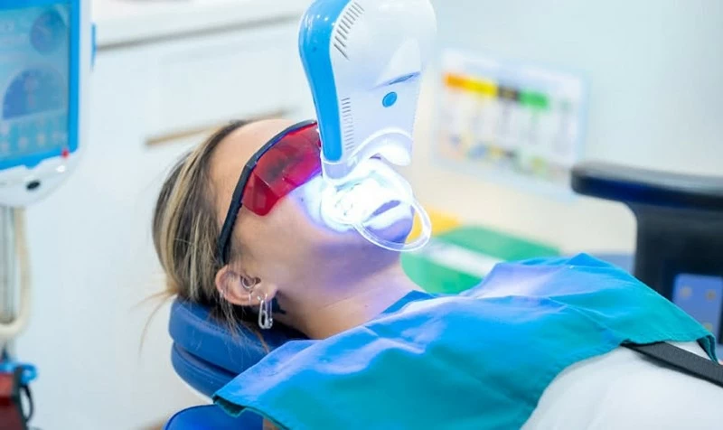 Khách hàng tẩy trắng răng lại Nha khoa Nhân Tâm. Khách hàng tẩy trắng răng lại Nha khoa Nhân Tâm.