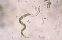 thanh nien o yen bai nhiem giun dai toi 60cm o bap tay