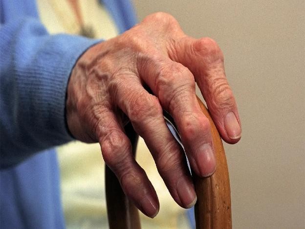 Hình ảnh viêm khớp. Hình ảnh viêm khớp.